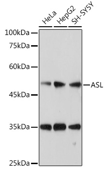 Anti-ASL Antibody (CAB6357)
