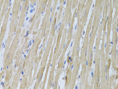 Anti-P2RY2 Antibody (CAB13923)