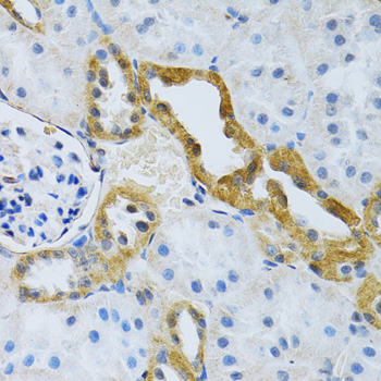 Anti-SLC4A5 Antibody (CAB10436)