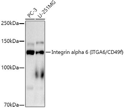 Western blot analysis of extracts of various cell lines, using Integrin alpha 6 (ITGA6/CD49f) antibody at 1:1000 dilution. Secondary antibody: HRP Goat Anti-Rabbit IgG (H+L) at 1:10000 dilution. Lysates/proteins: 25ug per lane. Blocking buffer: 3% nonfat dry milk in TBST. Detection: ECL Basic Kit. Exposure time: 180s.