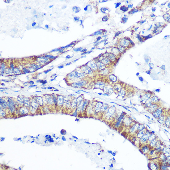 Anti-ABCG1 Antibody (CAB4328)