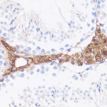 Anti-VTN Antibody (CAB1667)