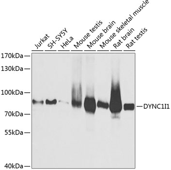 Anti-DYNC1I1 Antibody (CAB3833)