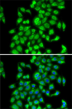 Anti-COPS3 Antibody (CAB7017)