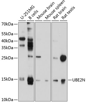 Anti-UBE2N Antibody (CAB10543)