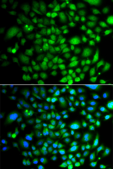 Anti-PTK6 Antibody (CAB7497)