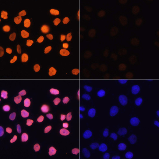 Anti-Acetyl-Histone H3-K4 Antibody (CAB16078)