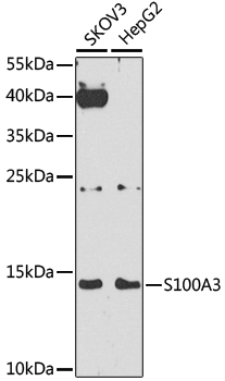 Anti-S100A3 Antibody (CAB4102)