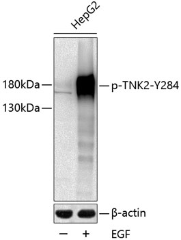 Anti-Phospho-TNK2-Y284 Antibody (CABP0589)