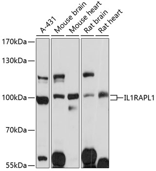 Anti-IL-1RAPL1 Antibody (CAB3378)