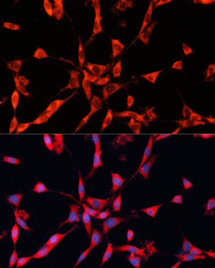 Anti-GARS Antibody (CAB5435)