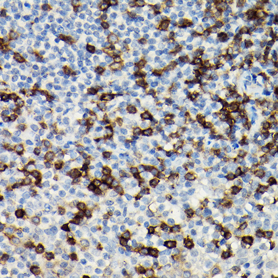 Anti-CD247 Antibody (CAB2058)