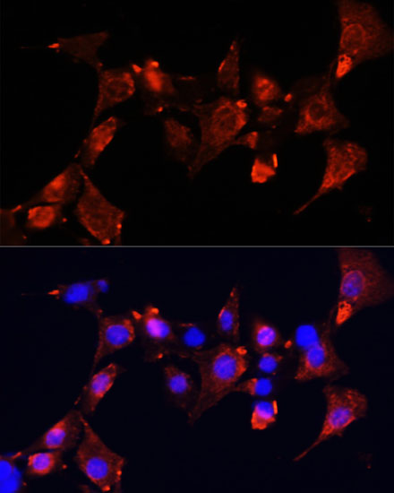 Anti-CLUH Antibody (CAB10140)