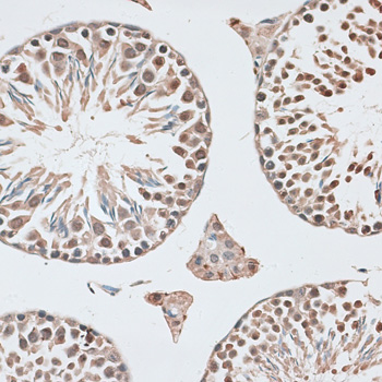 Anti-CBX6 Antibody (CAB5533)