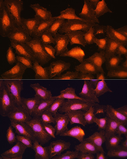 Anti-MDM2 Antibody (CAB13327)