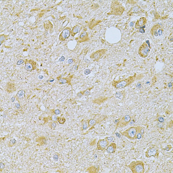 Anti-CAMK1G Antibody (CAB7379)