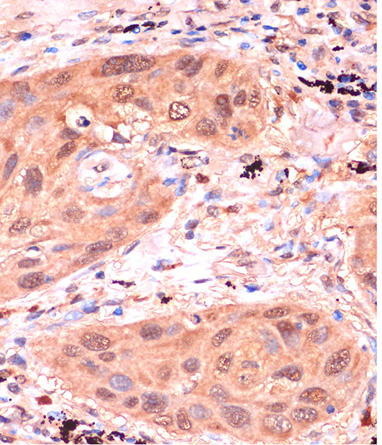 Anti-RPP38 Antibody (CAB17080)