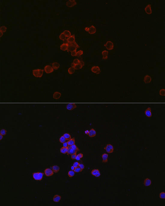 Immunofluorescence analysis of Jurkat cells using MYL12B antibody at dilution of 1:100. Blue: DAPI for nuclear staining.