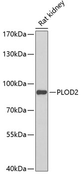 Anti-PLOD2 Antibody (CAB6946)