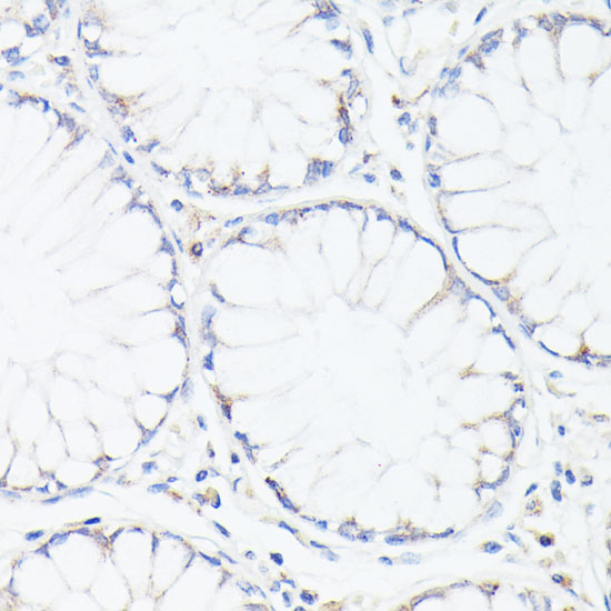 Anti-p53 Antibody [KO Validated] (CAB11232)