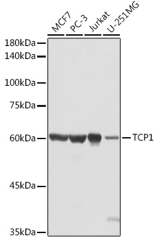 Anti-TCP1 Antibody (CAB13364)