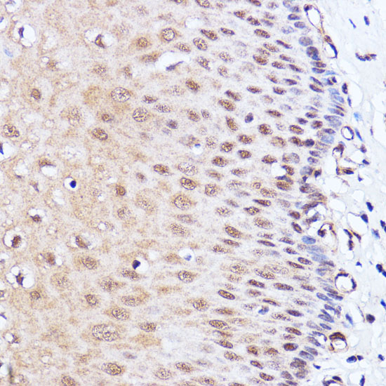 Anti-BRD4 Antibody (CAB2249)