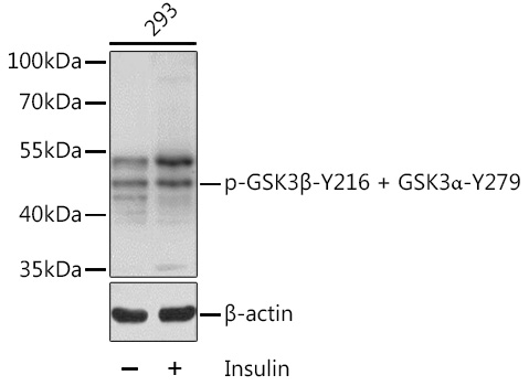 Anti-Phospho-GSK3B-Y216 Antibody (CABP0261)