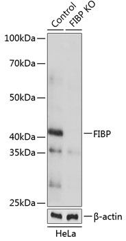 Anti-FIBP Antibody [KO Validated] (CAB19908)