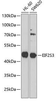 Anti-EIF2S3 Antibody (CAB6581)