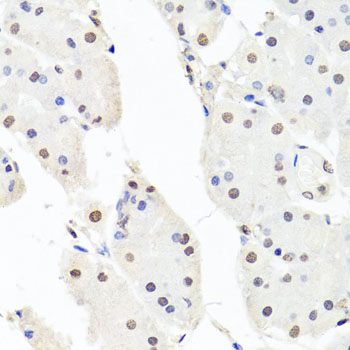 Anti-CHRAC1 Antibody (CAB7372)