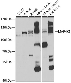 Anti-MAP4K5 Polyclonal Antibody (CAB7962)