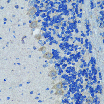 Anti-Nestin Antibody (CAB11861)