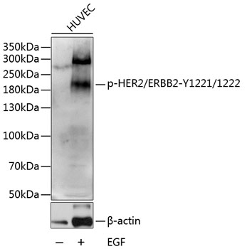 Anti-Phospho-ERBB2-Y1221/1222 Antibody (CABP0527)