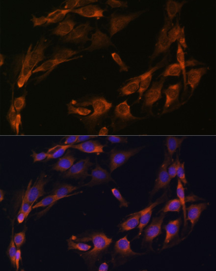 Anti-BGLAP Antibody (CAB6205)