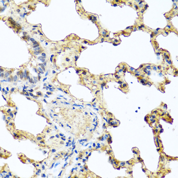 Anti-PIP Antibody (CAB6394)