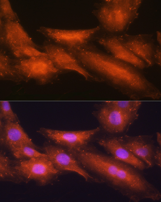 Anti-HINT1 Antibody [KO Validated] (CAB10221)