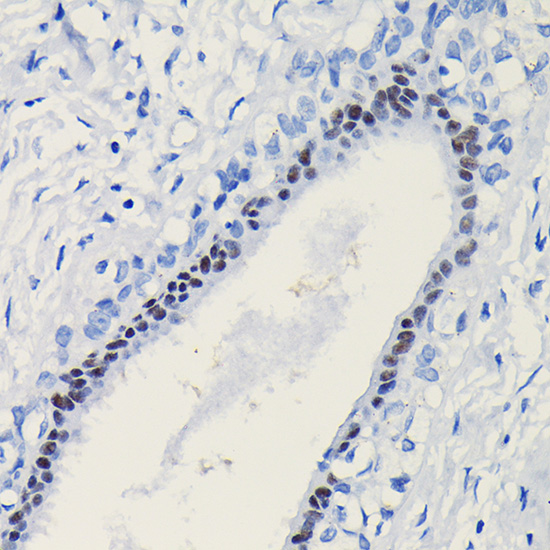 Anti-PGR Antibody (CAB0321)