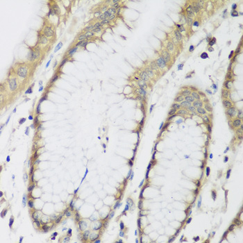 Anti-METTL7A Polyclonal Antibody (CAB8201)