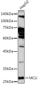 Anti-MCU Antibody (CAB16281)