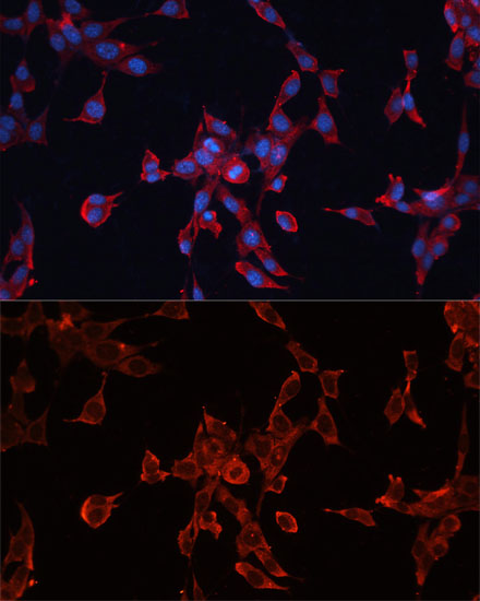 Anti-GPC3 Antibody (CAB12383)