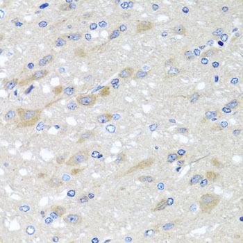 Anti-NDUFS3 Polyclonal Antibody [KO Validated] (CAB8013)