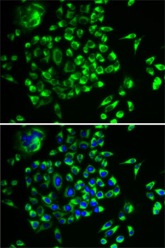 Anti-MRPL28 Antibody (CAB5897)