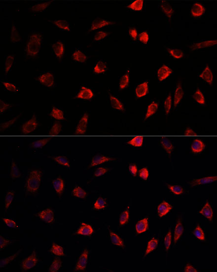 Anti-NEDD1 Antibody (CAB5128)