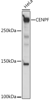 Anti-CENPF Antibody (CAB18644)