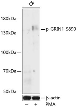 Anti-Phospho-GRIN1-S890 pAb (CABP0826)