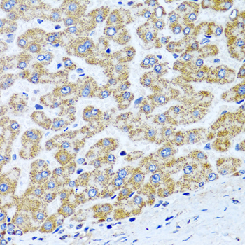 Anti-COL10A1 Antibody (CAB6889)