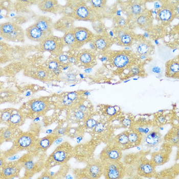 Anti-ARHGEF5 Antibody (CAB4196)