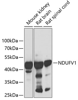 Anti-NDUFV1 Antibody (CAB13333)