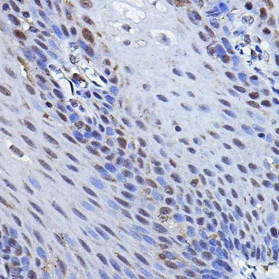 Anti-TP73 Antibody (CAB0385)