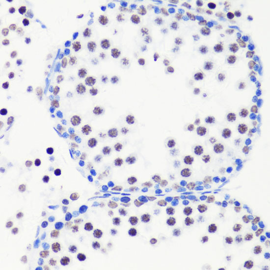 Anti-MonoMethyl-Histone H3-R8 Antibody (CAB3156)